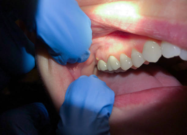 Best Cracked Tooth Emergency Dentist  in Bedford Heights, OH
