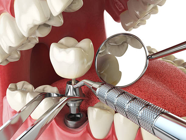Best Dentist for Tooth Abscess  in Bedford Heights, OH